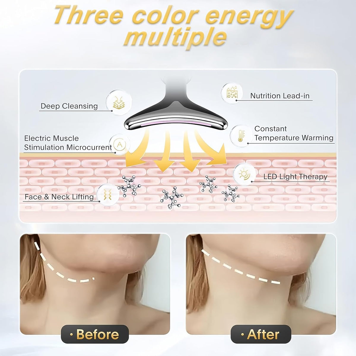 VEGENA Electric Face Massager – 3 Modes Anti-Wrinkle & Skin Tightening Beauty Device